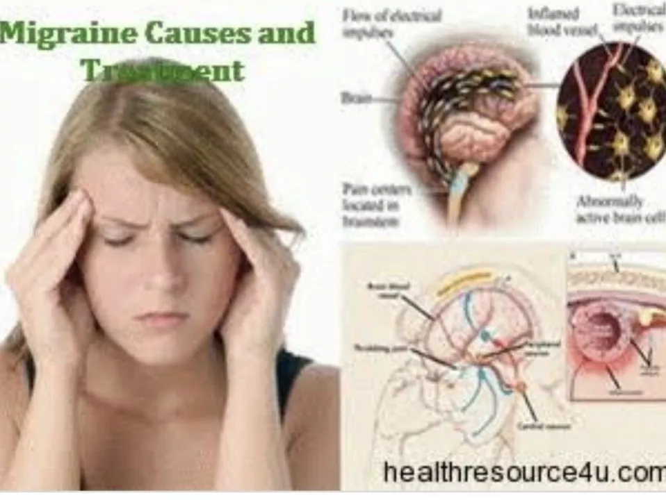 How dydrogesterone can help in managing menstrual migraines